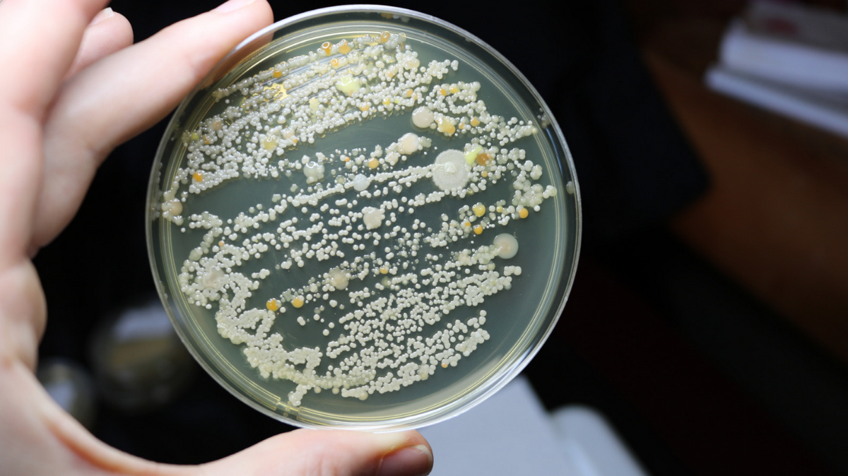 Iperclorazione Legionella Roma