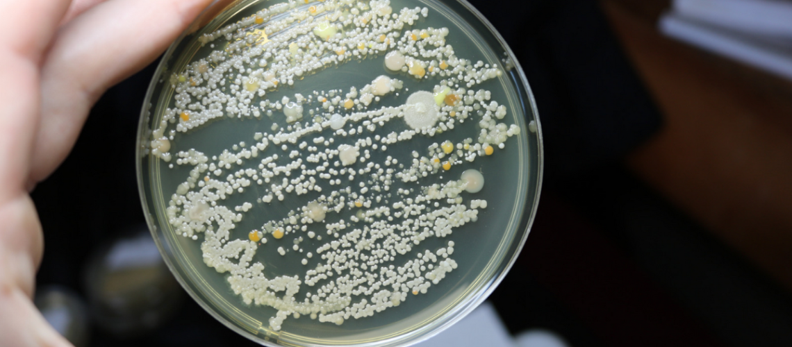 Iperclorazione Legionella Roma